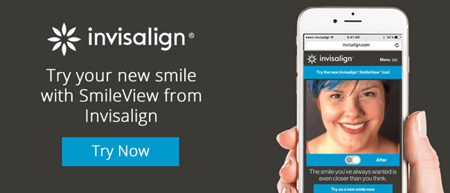 Invisalign